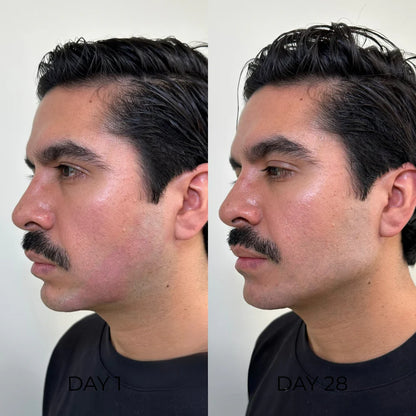 LymphEase Lymphatic Drainage Drops