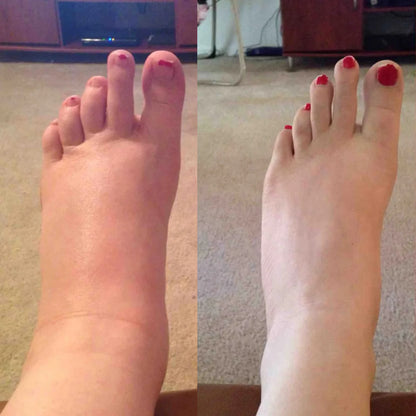 LymphEase Lymphatic Drainage Drops